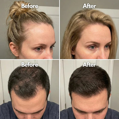 BUY 1 GET 1 FREE Hair Growth Roll-On Serum