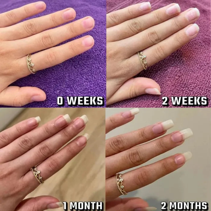 BUY 1 GET 1 FREE | Stem Cells Nail Growth Pen